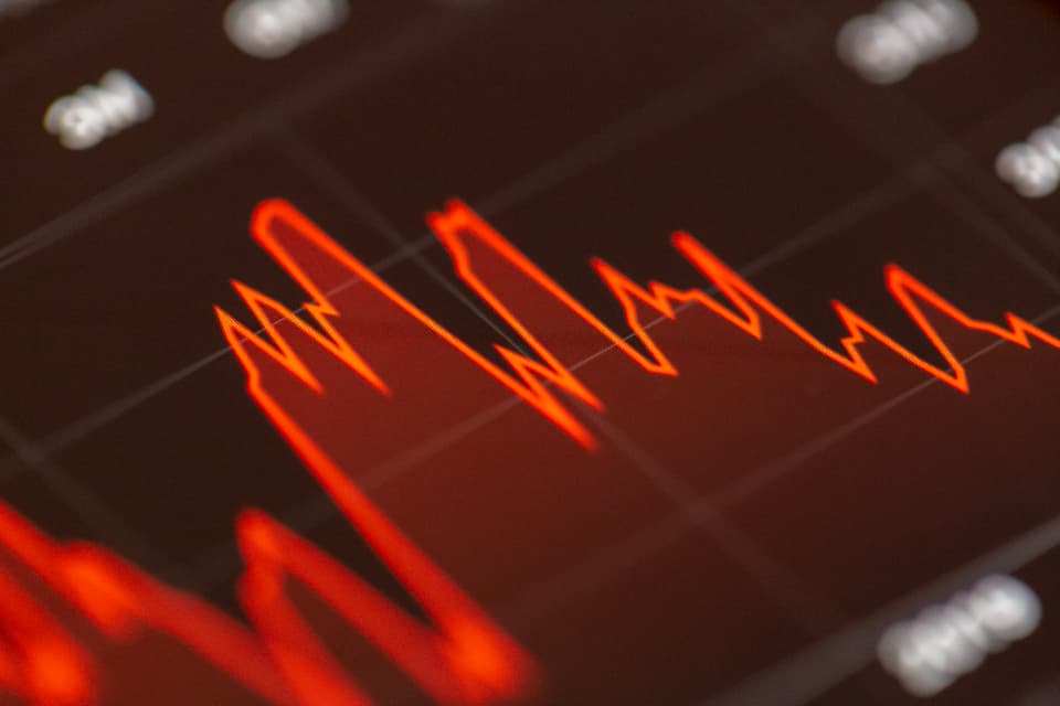 VOO vs QQQ 비교 2026: 한국 투자자, S&P500과 나스닥100 중 뭘 사야 할까